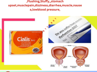 Cialis 5mg Tablets in pakistan | 0308-5356226 new