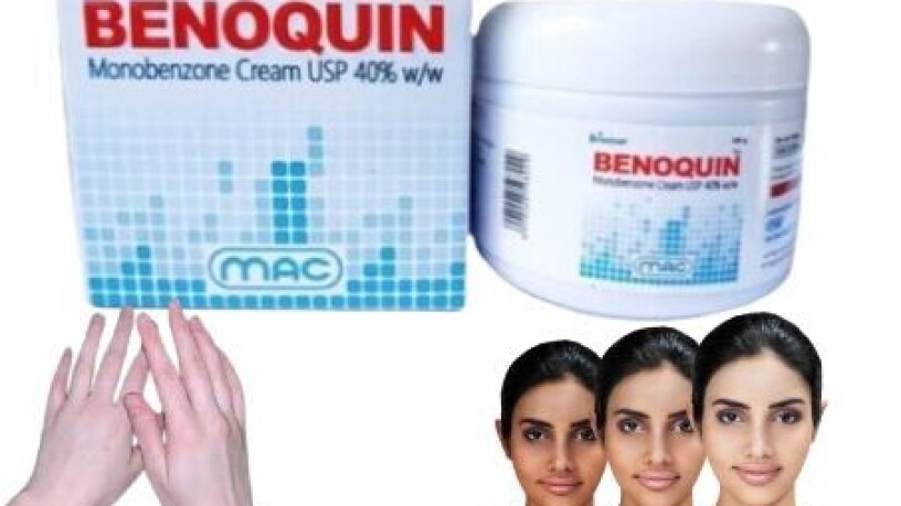 benoquin-monobenzone-cream-in-pakistan-03000378807-bara-big-0