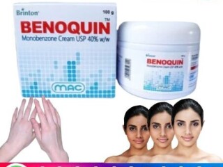 Benoquin Monobenzone Cream In Jhelum = 03000378807 +  [Bara ....]