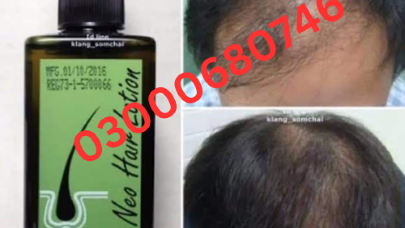 neo-hair-lotion-in-pakistan-03000680746-big-0