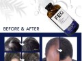 feg-plus-hair-growth-spray-price-in-muzaffarabad-03055997199-small-0