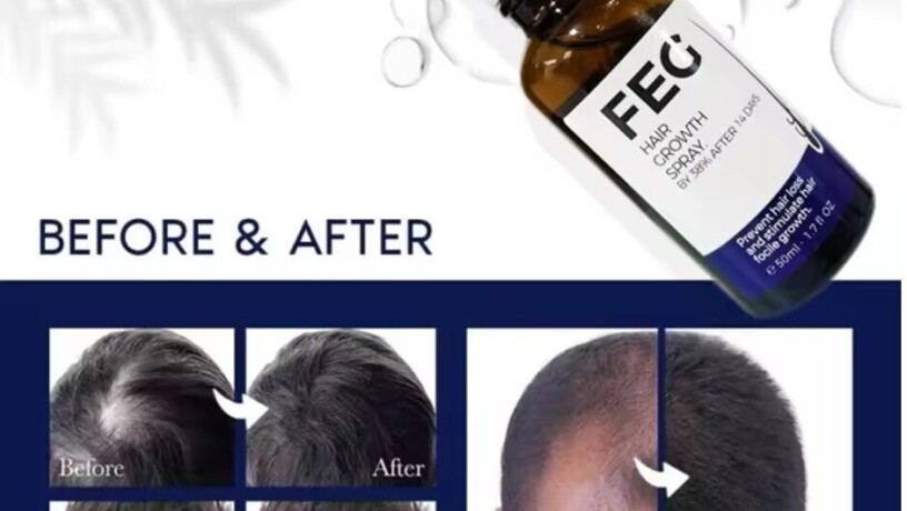 feg-plus-hair-growth-spray-price-in-muzaffarabad-03055997199-big-0