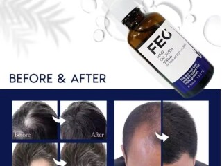 FEG Plus Hair Growth Spray price in Attock | 03055997199